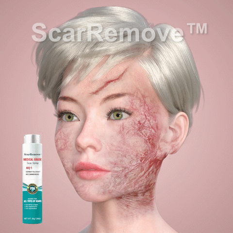 South Moon – Scar Spray | South Moon – بخاخ إزالة الندوب