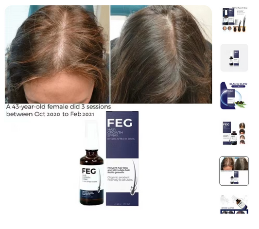 🔥 FEG Hair Growth Spray PLUS – Fast Hair Regrowth Solution for Men & Women | Thicker, Fuller Hair in Weeks | UAE Best Seller 🇦🇪