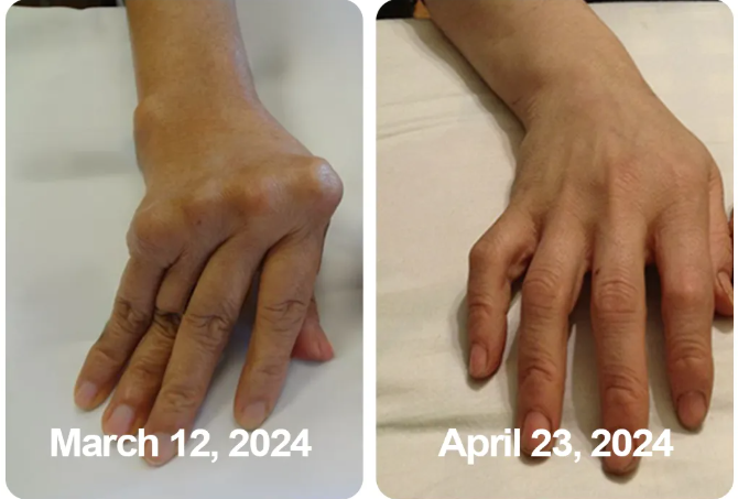 South Moon Bee Venom  Relief Cream | ساوث مون – كريم الجسم العشبي المهدئ