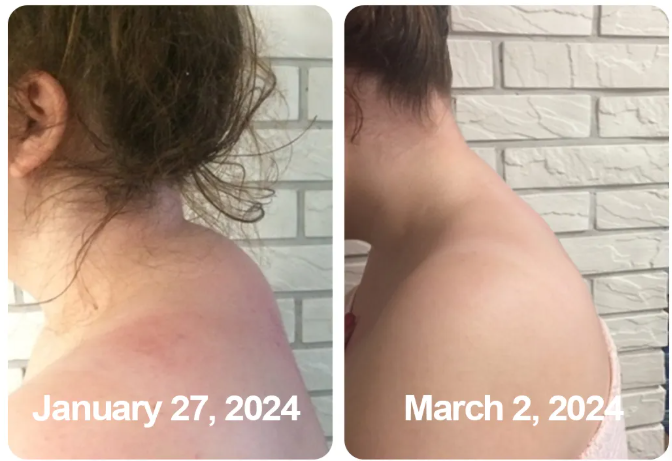 South Moon Bee Venom  Relief Cream | ساوث مون – كريم الجسم العشبي المهدئ