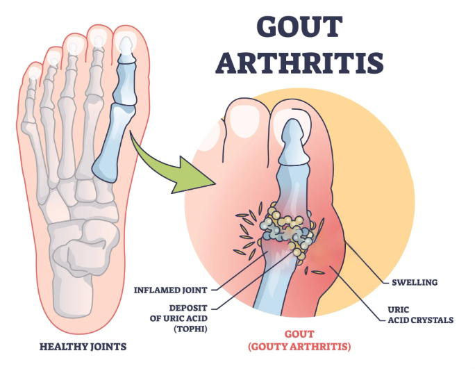 South Moon Bee Venom  Relief Cream | ساوث مون – كريم الجسم العشبي المهدئ
