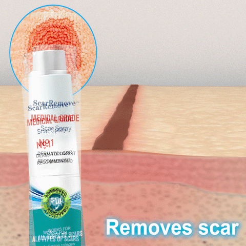 South Moon – Scar Spray | South Moon – بخاخ إزالة الندوب