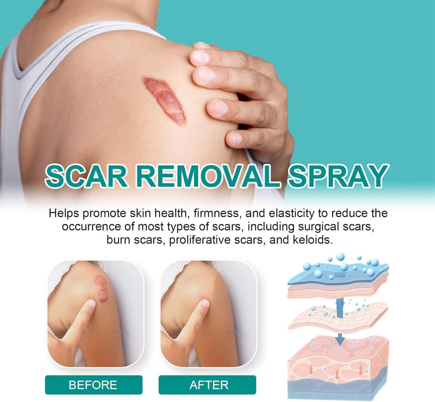 South Moon – Scar Spray | South Moon – بخاخ إزالة الندوب