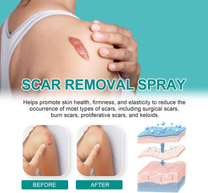 South Moon – Scar Spray | South Moon – بخاخ إزالة الندوب