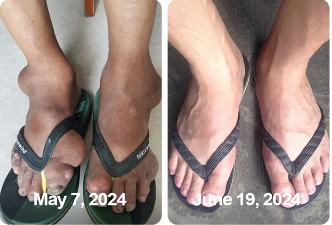 South Moon Bee Venom  Relief Cream | ساوث مون – كريم الجسم العشبي المهدئ