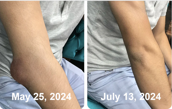 South Moon Bee Venom  Relief Cream | ساوث مون – كريم الجسم العشبي المهدئ