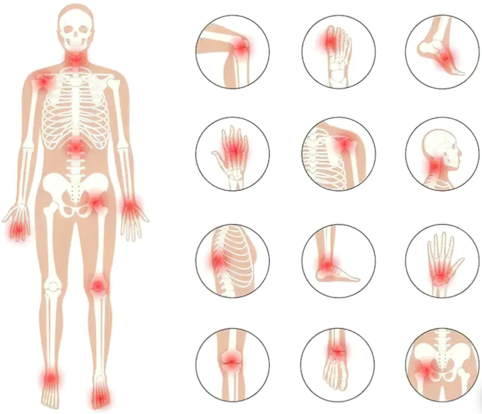 South Moon Bee Venom  Relief Cream | ساوث مون – كريم الجسم العشبي المهدئ