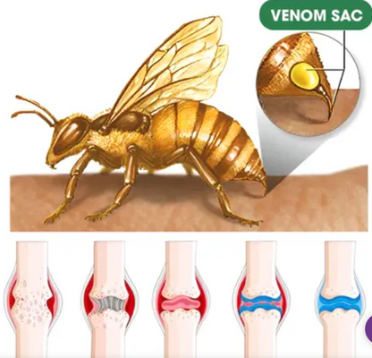 South Moon Bee Venom  Relief Cream | ساوث مون – كريم الجسم العشبي المهدئ