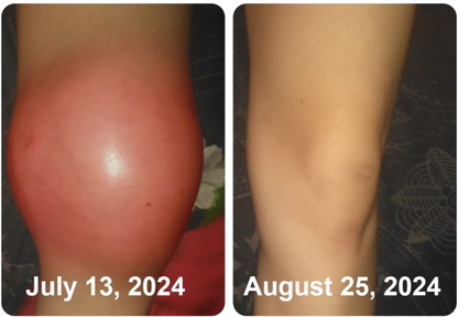 South Moon Bee Venom  Relief Cream | ساوث مون – كريم الجسم العشبي المهدئ